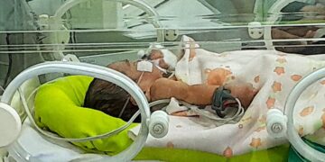 Dirawat Intensif di RSUKT, Begini Kondisi Bayi yang Ditemukan dalam Kantong Plastik