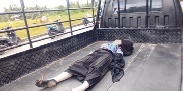 Motor Hilang Kendali di Tikungan, Dua Remaja Terpental, Kepala dan Bibirnya Memar