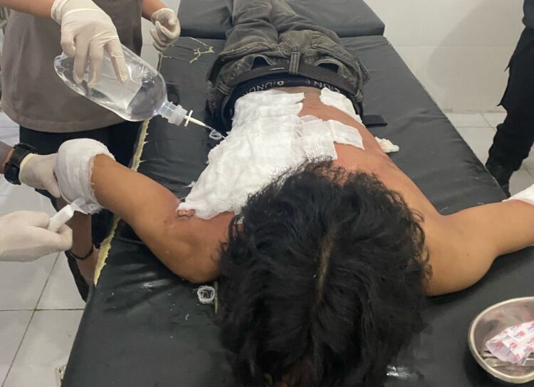 KNPI Kaltara Kutuk Keras Insiden Mahasiswa Terbakar Saat Unjuk Rasa : Usut Tuntas, Jangan Lindungi Oknum!